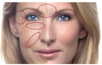 Fine Lines Mirodissolving Patches
