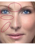 Fine Lines Mirodissolving Patches